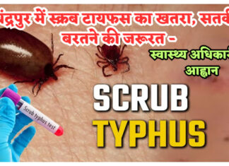 चंद्रपुर में स्क्रब टायफस का खतरा, सतर्कता जरूरी;स्वास्थ्य अधिकारी का आह्वान ! मनपा स्वास्थ्य केंद्रों में सुविधाओं की कमी से कर्मचारी-नागरिक परेशान